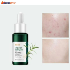  Fenyi Acne Treatment Serum For Women In Pakistan